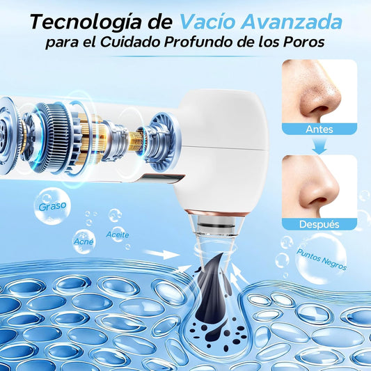 Limpiador Eléctrico de Poros Eficaz